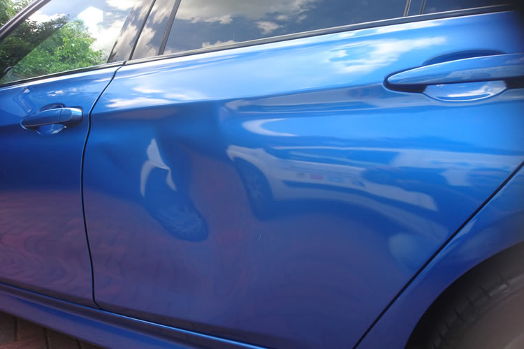 Dent Removal Recent Work By Body Tech